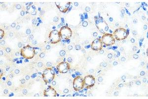 Immunohistochemistry of paraffin-embedded Mouse kidney using NOD1 Polyclonal Antibody at dilution of 1:100 (40x lens).