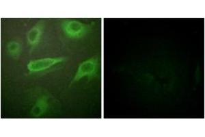 Immunofluorescence analysis of HeLa cells, using IL-4R/CD124 (Phospho-Tyr497) Antibody.