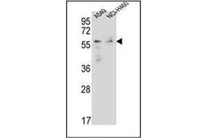Image no. 2 for anti-Forkhead Box N1 (FOXN1) (AA 357-386), (Middle Region) antibody (ABIN952376)