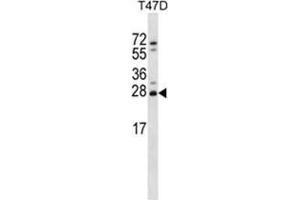 Image no. 1 for anti-Zinc Finger, Matrin Type 2 (ZMAT2) (AA 161-190), (C-Term) antibody (ABIN955674)
