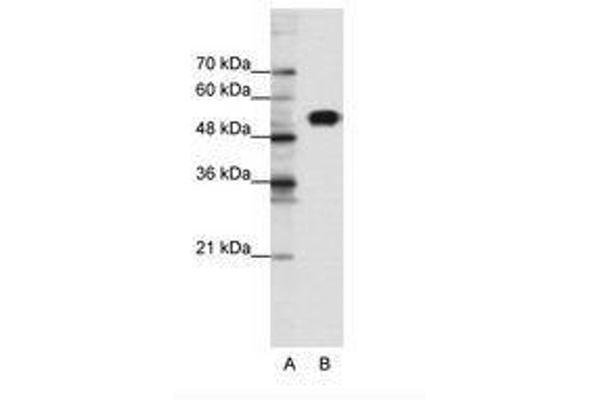 CLCNKB anticorps  (N-Term)