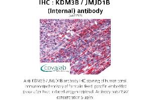 Image no. 2 for anti-Lysine (K)-Specific Demethylase 3B (KDM3B) (Internal Region) antibody (ABIN1736205)