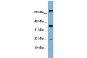Image no. 1 for anti-RWD Domain Containing 1 (RWDD1) (AA 71-120) antibody (ABIN6741945)