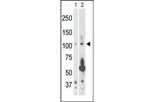 Image no. 1 for anti-Mitogen-Activated Protein Kinase Kinase Kinase 14 (MAP3K14) (Middle Region) antibody (ABIN360384)