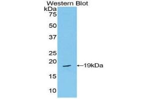 Image no. 1 for anti-Periostin (POSTN) (AA 659-810) antibody (ABIN1860276)