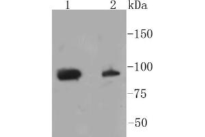 Image no. 2 for anti-Signal Transducer and Activator of Transcription 3 (Acute-Phase Response Factor) (STAT3) (pSer727) antibody (ABIN5557530)
