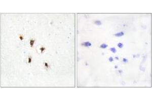 Image no. 2 for anti-Mevalonate Kinase (MVK) (AA 151-200) antibody (ABIN1533828)
