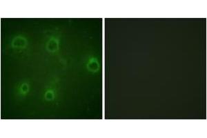 Immunofluorescence analysis of COS7 cells, using IL-8R beta/CDw128 beta (Phospho-Ser347) Antibody.