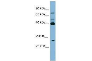 Image no. 1 for anti-Transglutaminase 3 (E Polypeptide, Protein-Glutamine-gamma-Glutamyltransferase) (TGM3) (N-Term) antibody (ABIN2777149)