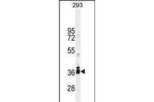 anti-Stimulated By Retinoic Acid 8 (STRA8) (AA 286-315), (C-Term) antibody