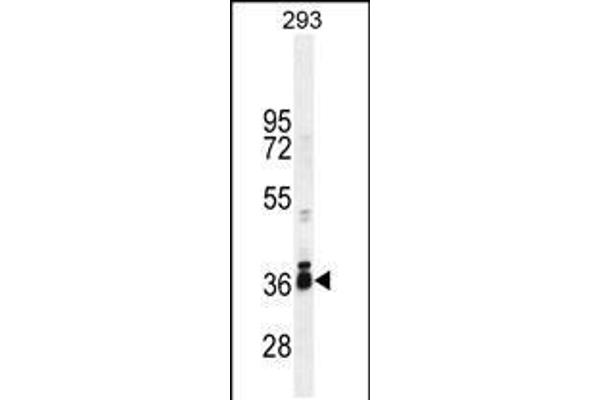 anti-Stimulated By Retinoic Acid 8 (STRA8) (AA 286-315), (C-Term) antibody