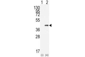 Image no. 2 for anti-Caudal Type Homeobox 2 (CDX2) (AA 1-30) antibody (ABIN3030336)