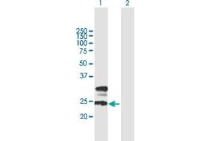 Image no. 1 for anti-Transmembrane Protein 27 (TMEM27) (AA 1-222) antibody (ABIN528161)