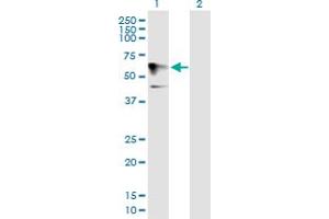 Image no. 1 for anti-Homeobox and Leucine Zipper Encoding (HOMEZ) (AA 1-526) antibody (ABIN528241)