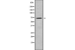 Image no. 2 for anti-Solute Carrier Family 25, Member 13 (Citrin) (slc25a13) (C-Term) antibody (ABIN6265118)