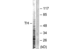 Image no. 2 for anti-Tyrosine Hydroxylase (TH) (Ser19) antibody (ABIN1847900)