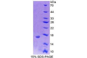 Image no. 1 for Small Nuclear Ribonucleoprotein D1 Polypeptide 16kDa (SNRPD1) (AA 1-119) protein (His tag) (ABIN2126801)