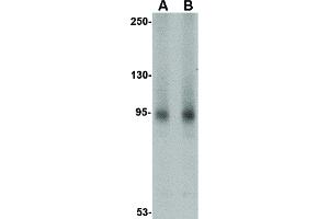 Image no. 2 for anti-AP2 associated kinase 1 (AAK1) (N-Term) antibody (ABIN6656603)
