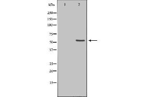 Image no. 2 for anti-Ets Variant 6 (ETV6) antibody (ABIN6258775)