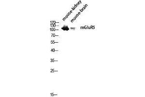 Image no. 2 for anti-Glutamate Receptor, Metabotropic 5 (GRM5) (N-Term) antibody (ABIN3185549)