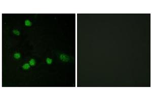 Image no. 3 for anti-V-Raf-1 Murine Leukemia Viral Oncogene Homolog 1 (RAF1) (Ser621) antibody (ABIN1847970)