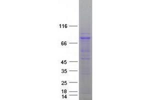 Image no. 1 for Zyg-11 Family Member B, Cell Cycle Regulator (ZYG11B) protein (Myc-DYKDDDDK Tag) (ABIN2736193)