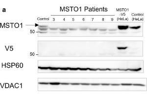 Image no. 3 for anti-Misato Homolog 1 (MSTO1) (Center) antibody (ABIN2856039)