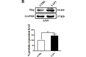 Image no. 9 for anti-Glyceraldehyde-3-Phosphate Dehydrogenase (GAPDH) antibody (ABIN3020541)