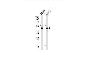 Image no. 1 for anti-Prostaglandin D2 Receptor (PTGDR) antibody (ABIN1944812)