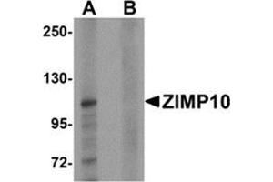 Image no. 1 for anti-Zinc Finger, MIZ-Type Containing 1 (ZMIZ1) (N-Term) antibody (ABIN783452)
