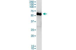 Image no. 2 for anti-Dihydropyrimidinase-Like 4 (DPYSL4) (AA 1-572) antibody (ABIN948962)