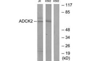 Image no. 1 for anti-AarF Domain Containing Kinase 2 (ADCK2) (AA 241-290) antibody (ABIN1533975)
