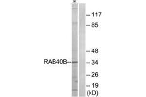 Image no. 1 for anti-RAB40B, Member RAS Oncogene Family (RAB40B) (AA 229-278) antibody (ABIN1535275)