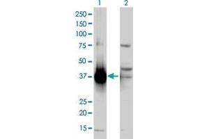Western Blotting (WB) image for AKR1C2 HEK293 Cell Transient Overexpression Lysate(Non-Denatured) (ABIN1339769)