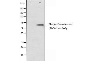 anti-Synaptotagmin (SYT) (pThr202) antibody