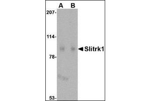 Image no. 2 for anti-SLIT and NTRK-Like Family, Member 1 (SLITRK1) (C-Term) antibody (ABIN500750)