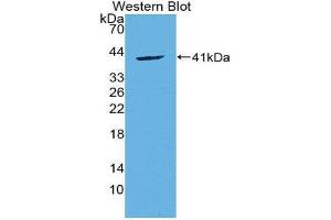 anti-Chemokine (C-C Motif) Ligand 20 (CCL20) (AA 24-95) antibody