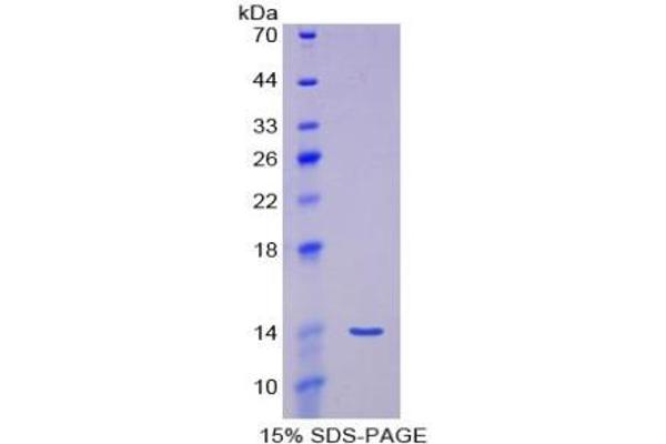 MSTN ELISA Kit