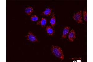 Proximity Ligation Assay (PLA) image for ACTN4 & CTNNB1 Protein Protein Interaction Antibody Pair (ABIN1339891)