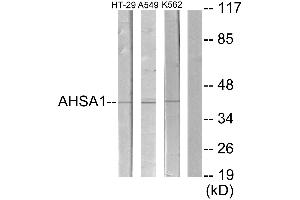 Collagen Type IX alpha 2 (COL9A2) (Internal Region) antibody
