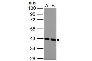 Image no. 3 for anti-Calponin 3, Acidic (CNN3) (Center) antibody (ABIN2856266)