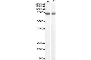 Image no. 6 for anti-Apoptosis-Inducing Factor, Mitochondrion-Associated, 1 (AIFM1) (C-Term) antibody (ABIN2630015)