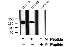 Image no. 3 for anti-Cystic Fibrosis Transmembrane Conductance Regulator (ATP-Binding Cassette Sub-Family C, Member 7) (CFTR) (pSer737) antibody (ABIN6271250)