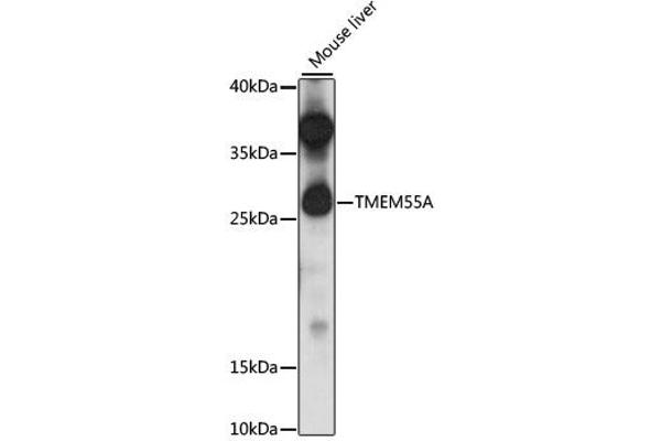 TMEM55A antibody