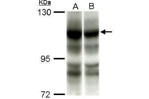 Image no. 1 for anti-Phosphoinositide-3-Kinase, Catalytic, alpha Polypeptide (PIK3CA) (N-Term) antibody (ABIN2854758)
