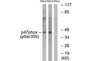 Western blot analysis of extracts from HeLa cells treated with nocodazole 1ug/ml 18h, using p47 phox (Phospho-Ser359) Antibody.