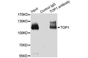Image no. 1 for anti-Topoisomerase (DNA) I (TOP1) antibody (ABIN6149391)