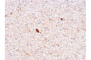 Image no. 3 for anti-Amyloid P Component, Serum (APCS) (AA 143-223) antibody (ABIN6939659)