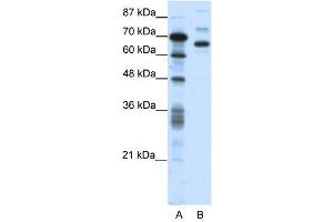 Image no. 1 for anti-CCCTC-Binding Factor (Zinc Finger Protein)-Like (CTCFL) (N-Term) antibody (ABIN927566)