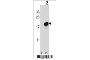 Western Blotting (WB) image for anti-CKLF-Like MARVEL Transmembrane Domain Containing 7 (CMTM7) antibody (ABIN2158293)